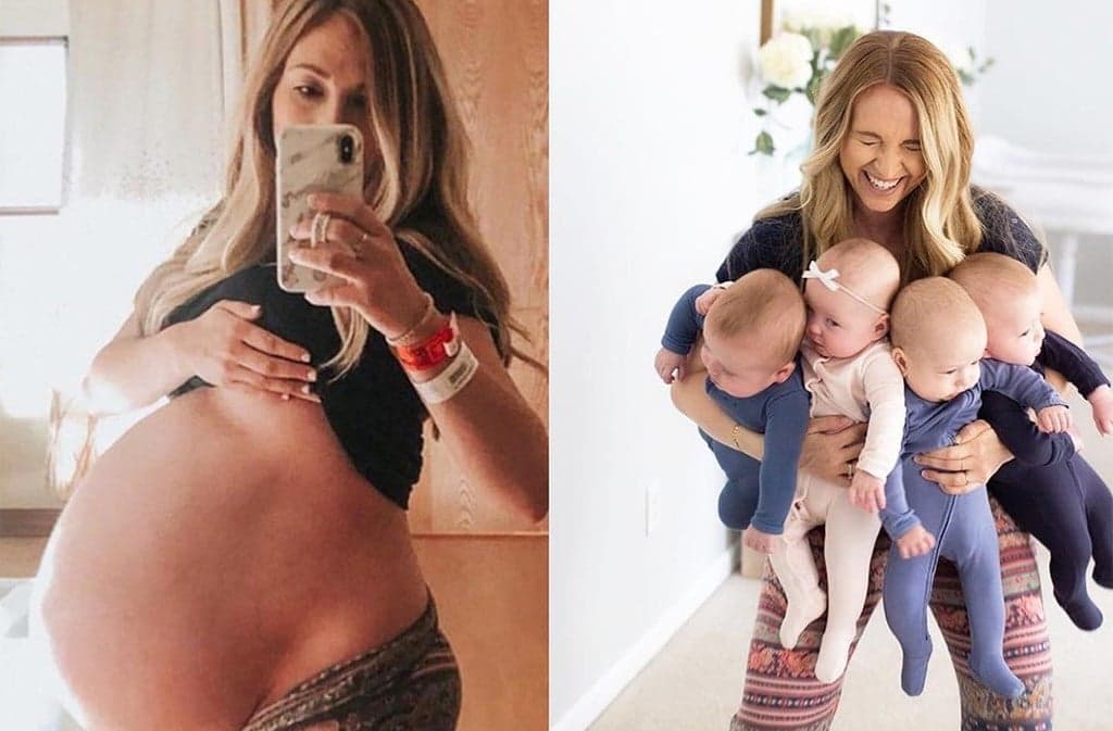 Las fotos de antes y después del embarazo de la mamá de cuatrillizos son increíbles