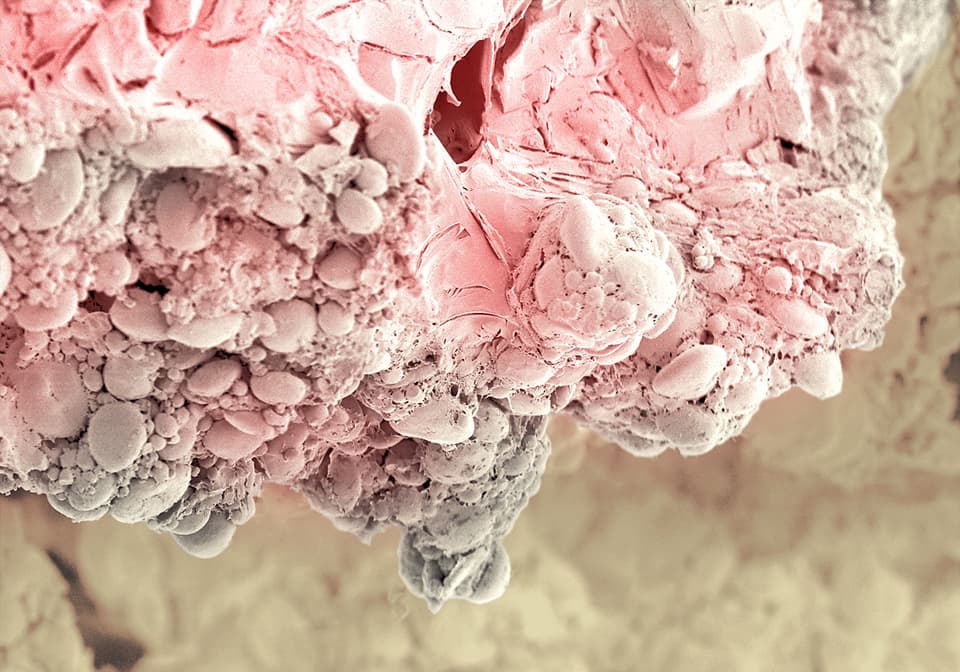 Pastel debajo de un microscopio