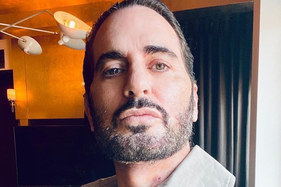 Marc Jacobs revela públicamente su experiencia con la cirugía plástica.
