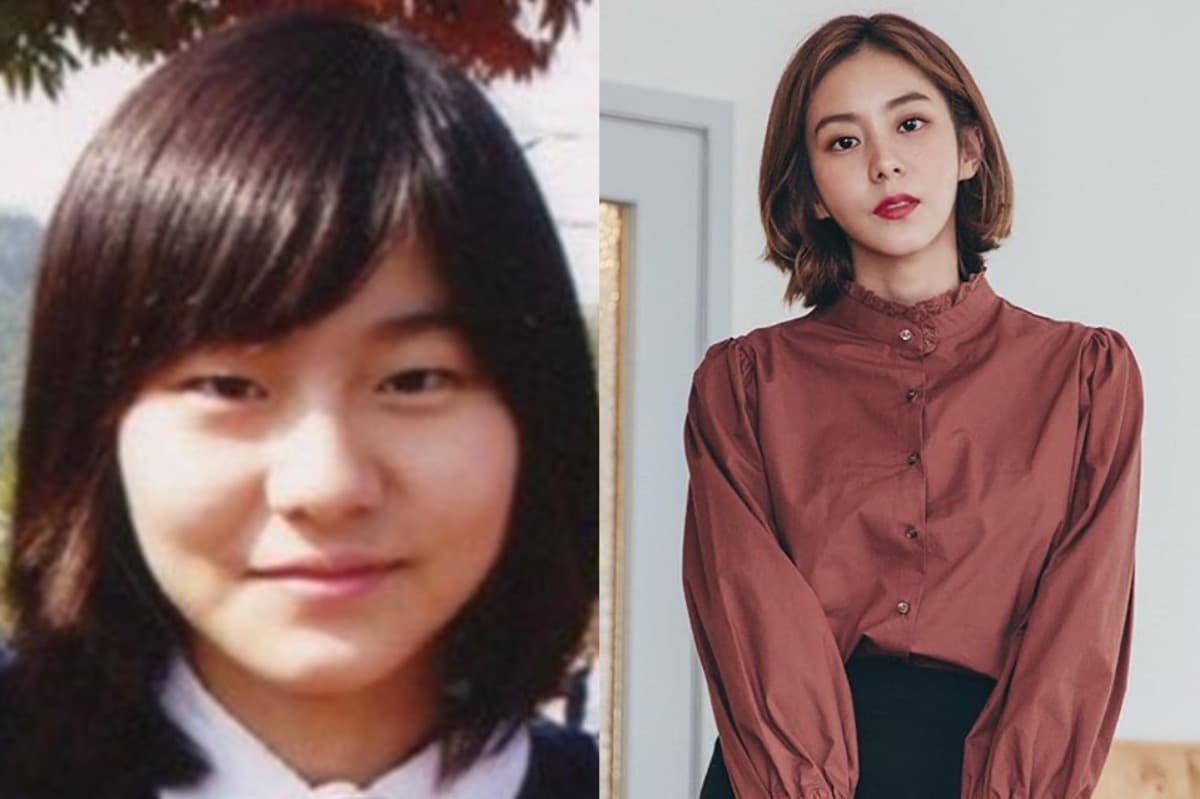 K-Pop y la cirugía estética: una conexión inseparable.