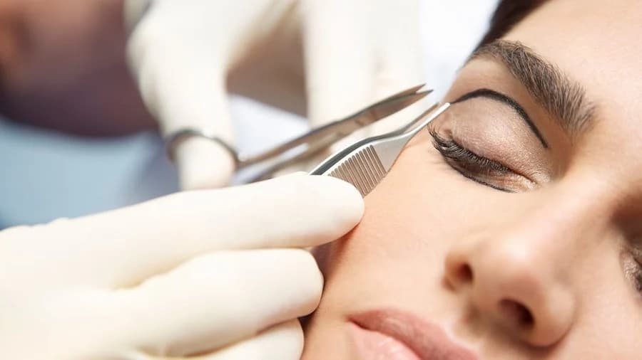 Tipos de cirugía de párpados Blefaroplastia – cirugía de párpados para una mirada más fresca y joven Su Belleza