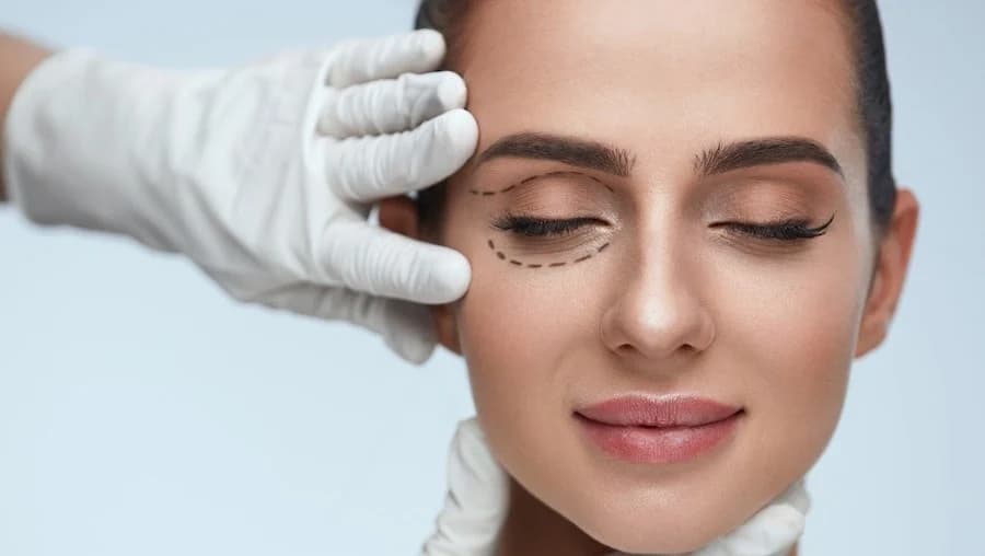 Cirugías funcionales de párpados Blefaroplastia – cirugía de párpados para una mirada más fresca y joven His Beauty