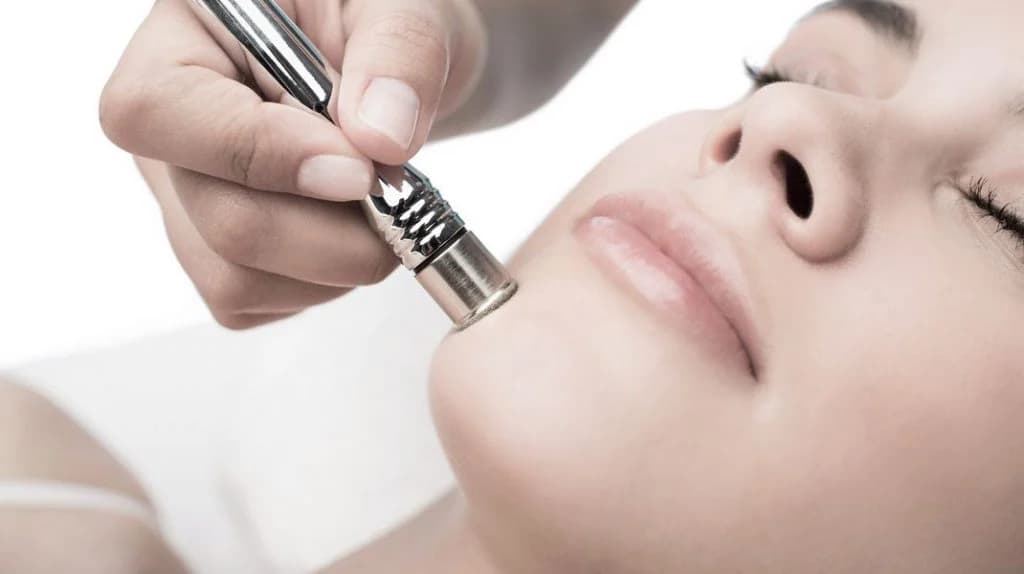 Efectos secundarios | ¿Qué es la microdermoabrasión y mejorará tu piel? su belleza