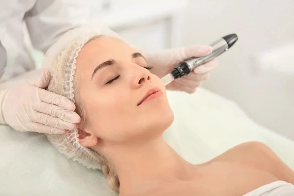 Microneedling |: Todo lo que necesitas saber sobre Microneedling | su belleza