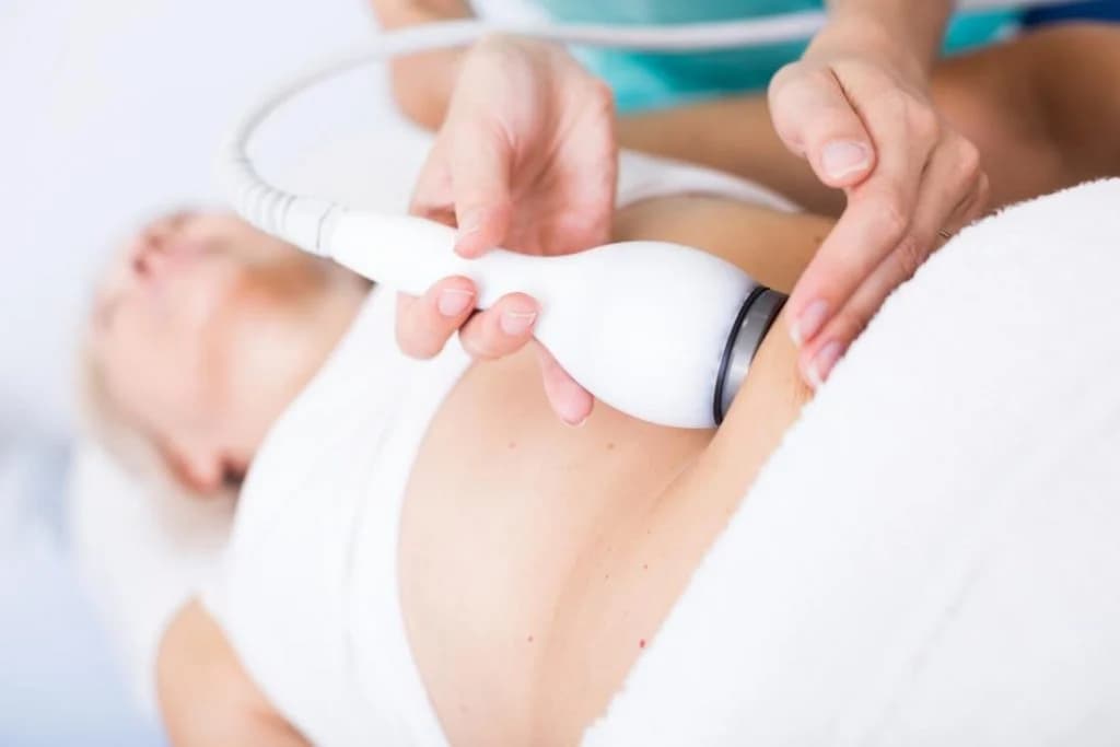 CoolSculpting | Todo lo que necesitas saber sobre la abdominoplastia no quirúrgica | su belleza