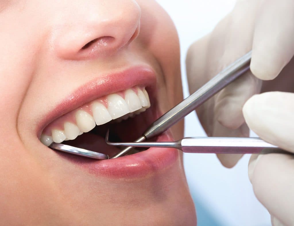 Examen dental | 8 autocontroles que toda mujer debe hacer | su belleza
