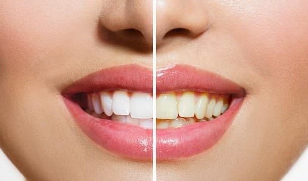 Adiós dientes blancos 7 razones para pasar del café al té | su belleza