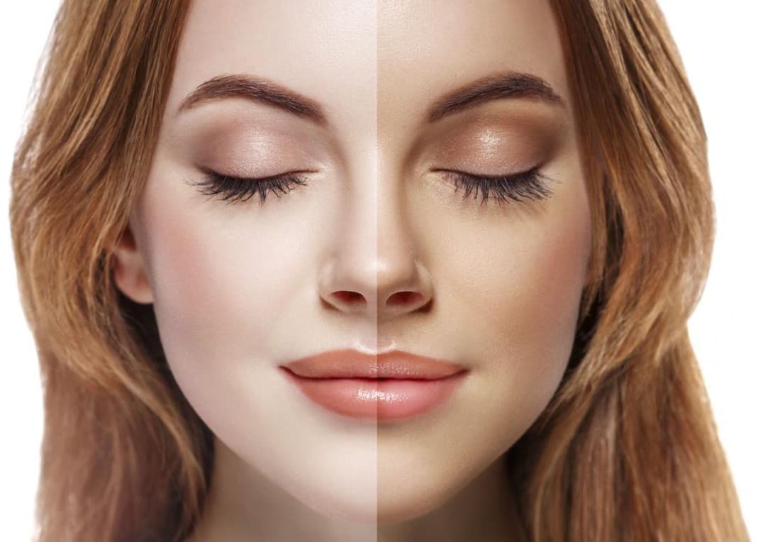 Guía completa sobre las inyecciones de bronceado: todo lo que debes conocer.