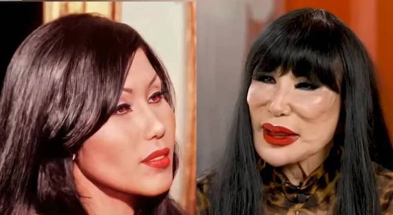 La desgarradora historia oculta tras el cambio facial de Lin Mei.