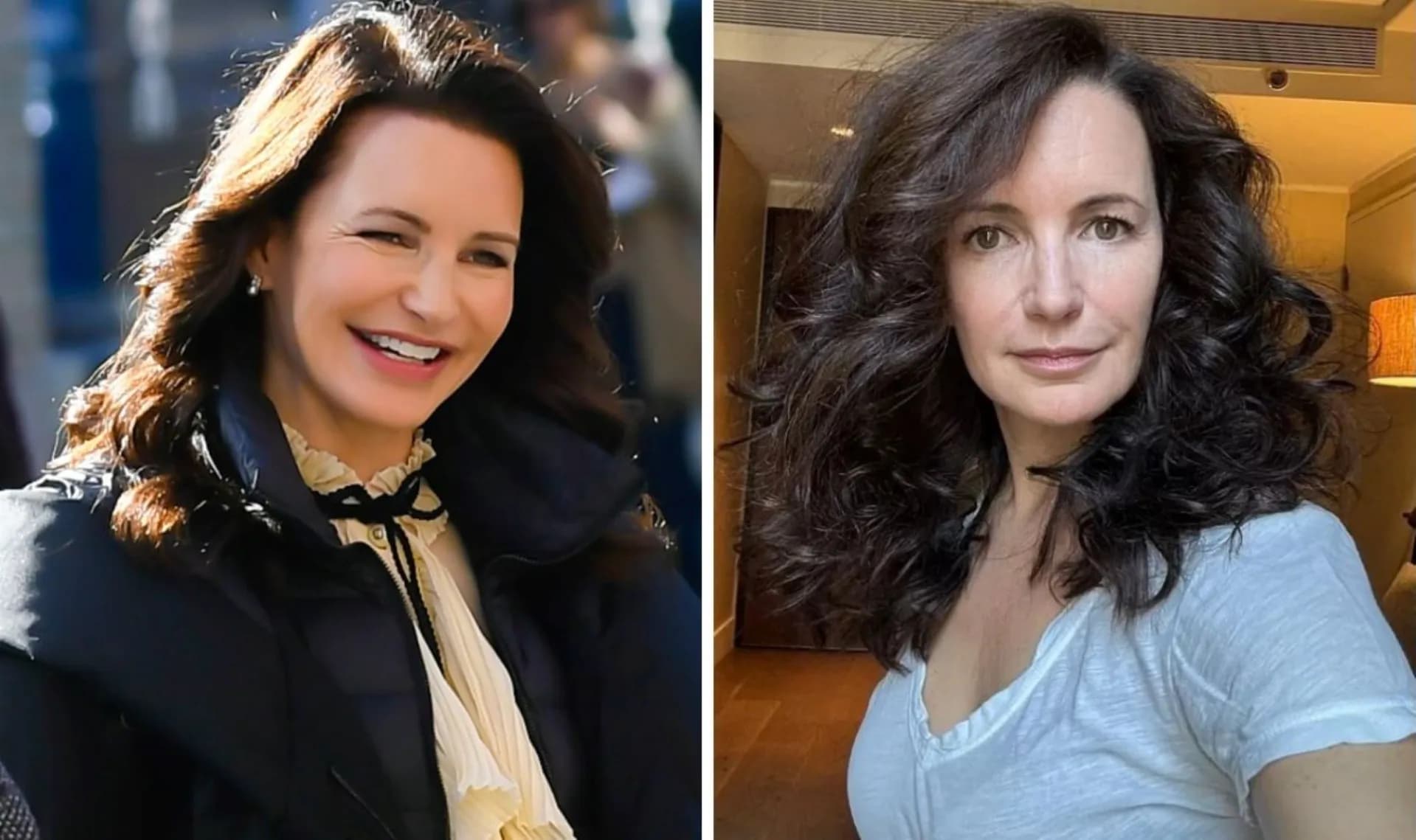 10 famosos que se ven mejor tras eliminarse los rellenos.