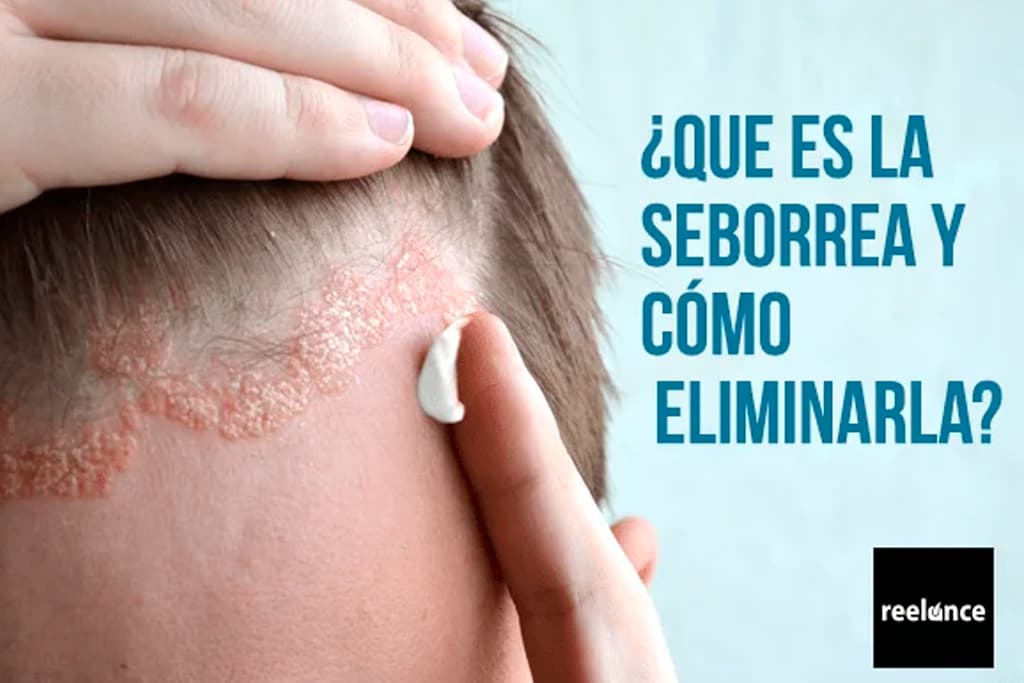 la alergia causa granos en la cara