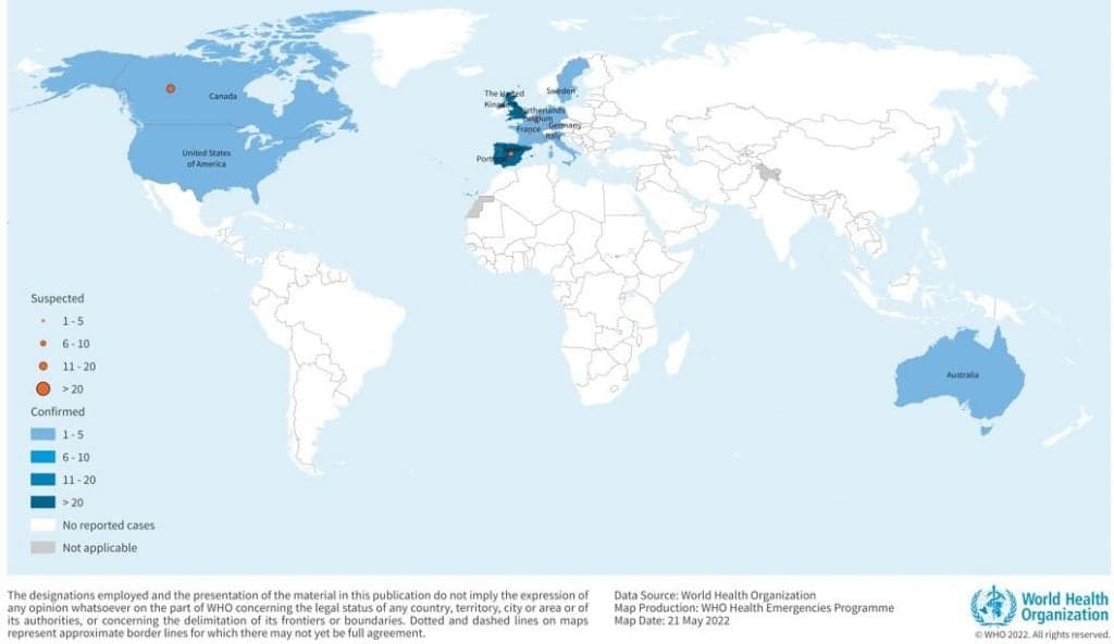 ¿Se convertirá Monkeypox en el nuevo COVID?