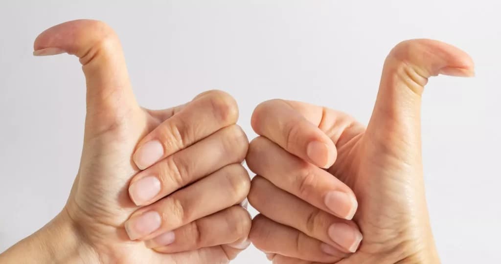¿Cuál es la razón detrás de que algunas personas tengan dedos con dos lados?