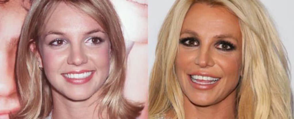 Britney Spears: comparativa de su rostro en el pasado y el presente a través de imágenes.