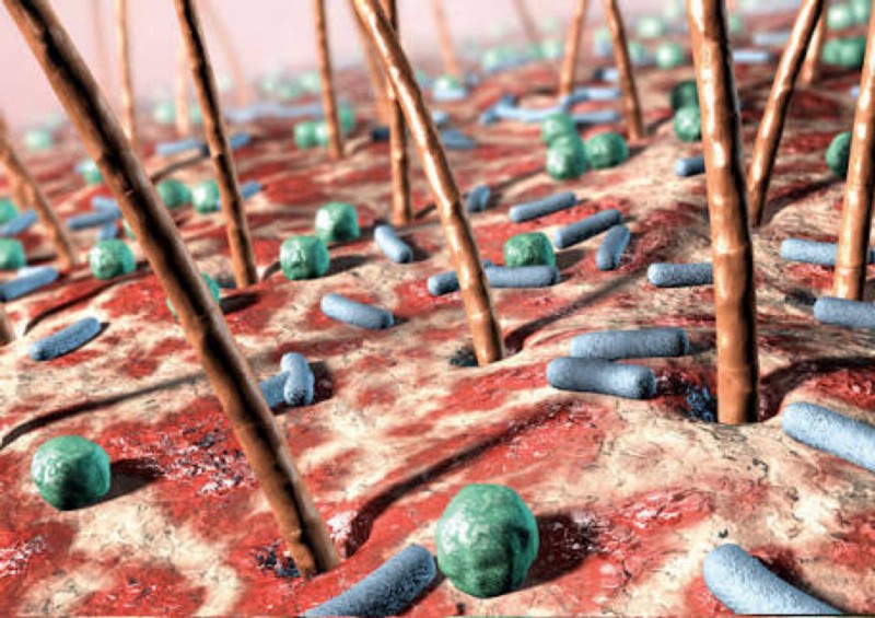 20 Hechos 18-Bacterias