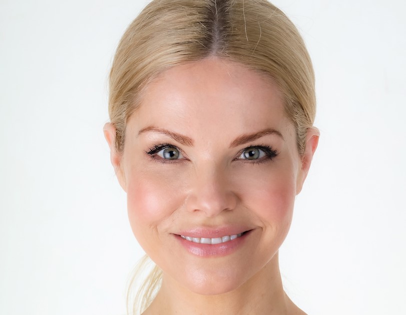La cara se paraliza 7 razones para no hacer Botox | su belleza