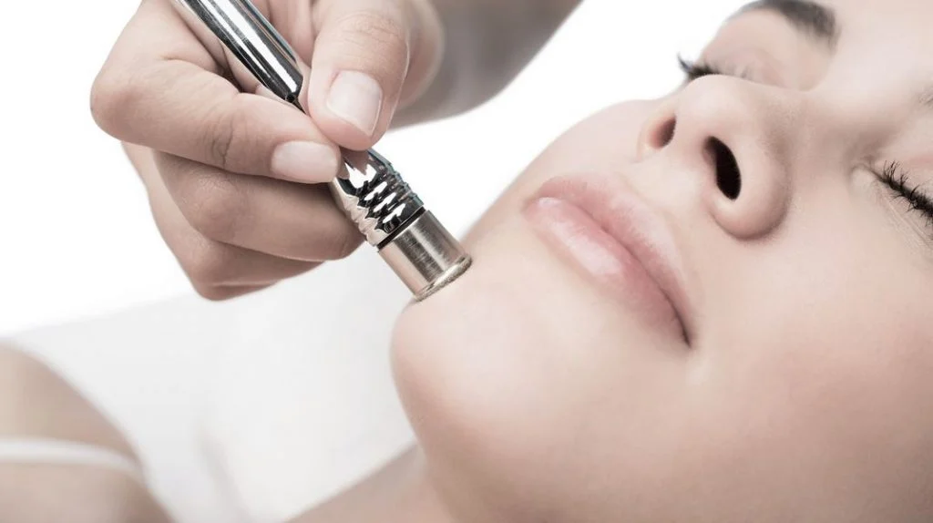 Efectos secundarios | ¿Qué es la microdermoabrasión y mejorará tu piel? su belleza