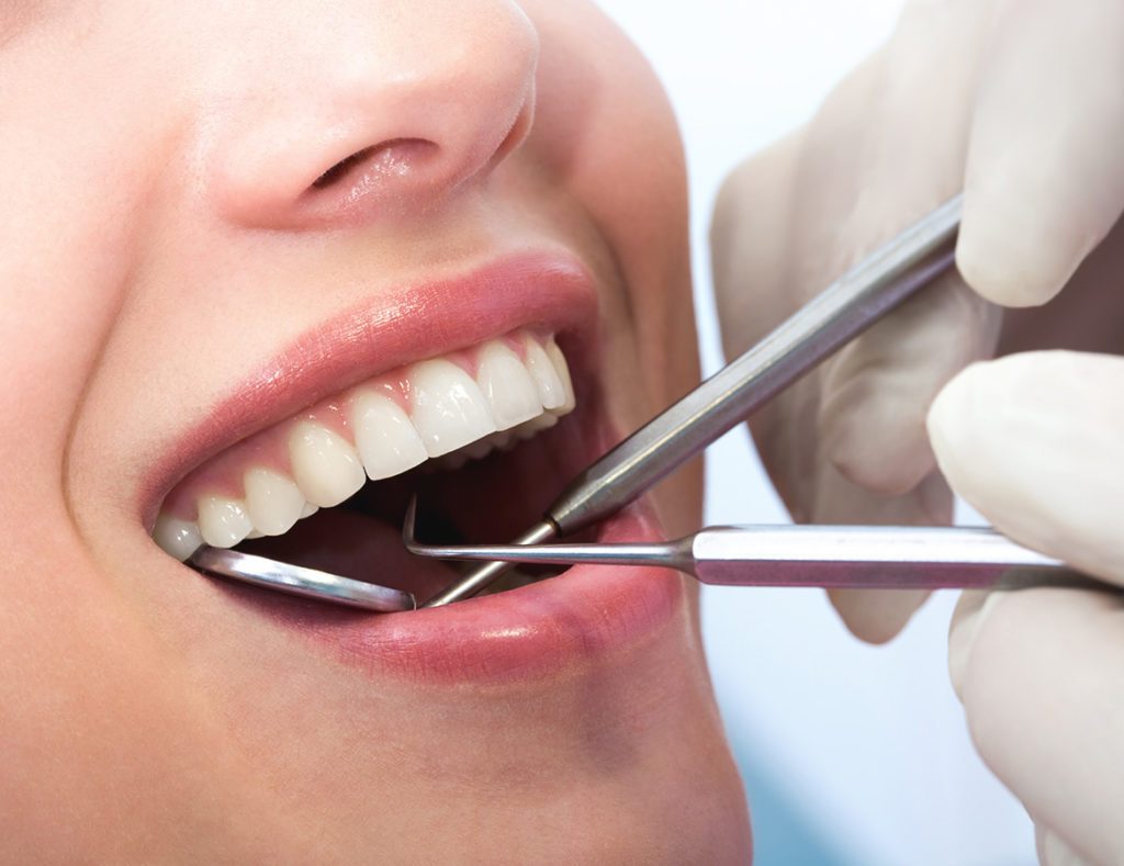 Examen dental | 8 autocontroles que toda mujer debe hacer | su belleza